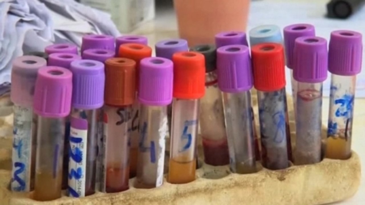 Guinean government confirms disease that killed 34 as Ebola