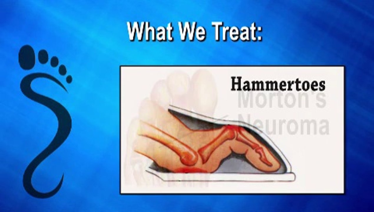 Alan Rothstein, DPM - Podiatrist in Atlanta, Marietta and Fulton County, GA - Windy Hill Podiatry