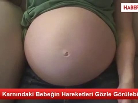 Anne Karnındaki Bebeğin Hareketleri Gözle Görülebiliyor