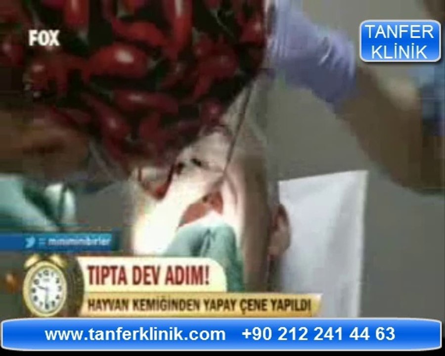 Tanfer Klinik - Fox Haber 10_09_2012