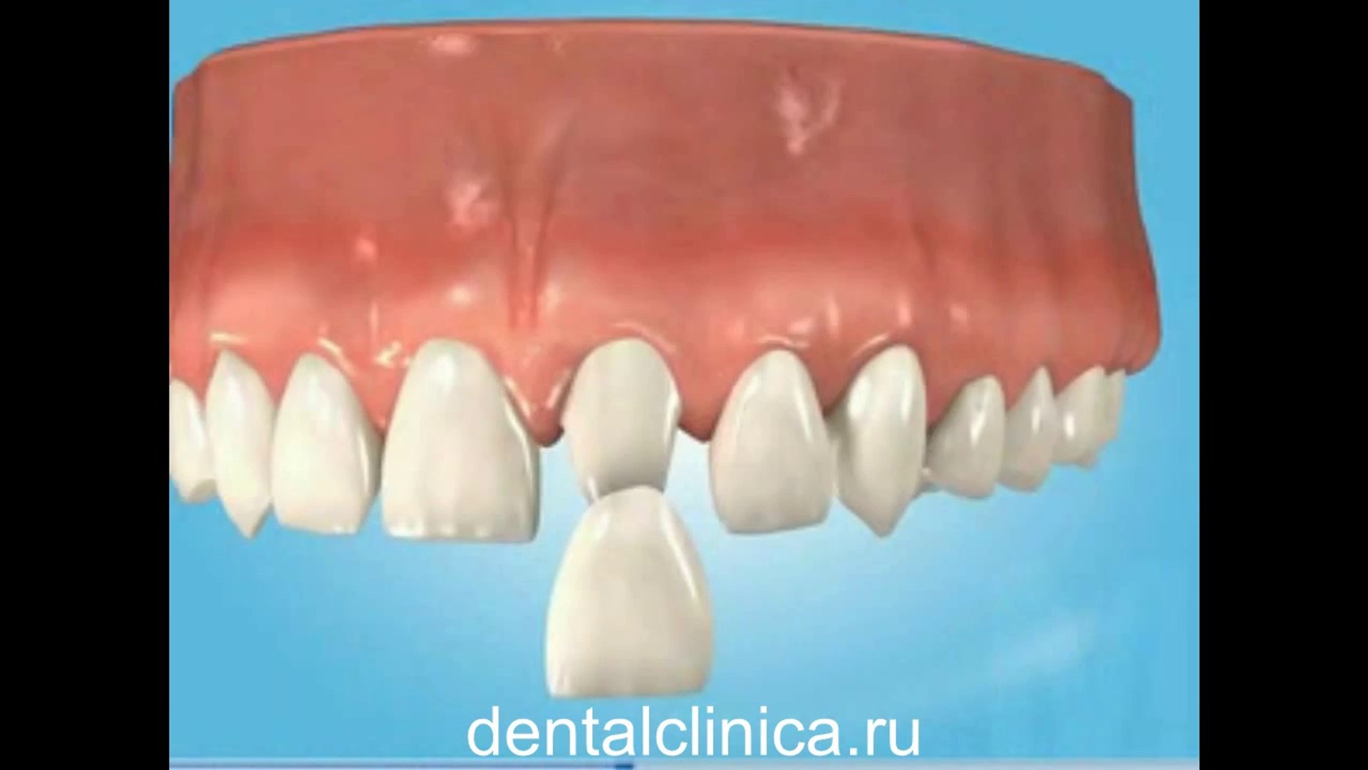 ⁣European Clinic of Aesthetic Dentistry Стоматология лечение протезирование имплантация пластическая 