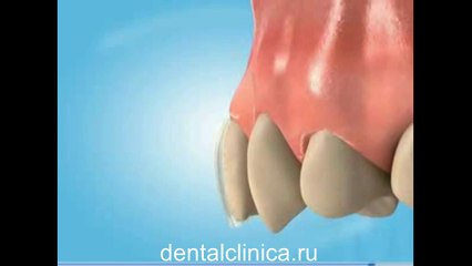 Международная клиника имплантологии эстетической стоматологии в Будапеште Профессиональное и доступное лечение зубов