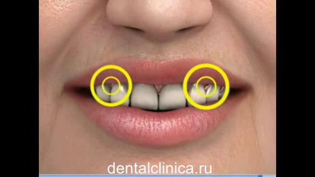 Стоматологические услуги, лечение зубов не дорого и качественно Международная клиника имплантологии эстетической стоматологии