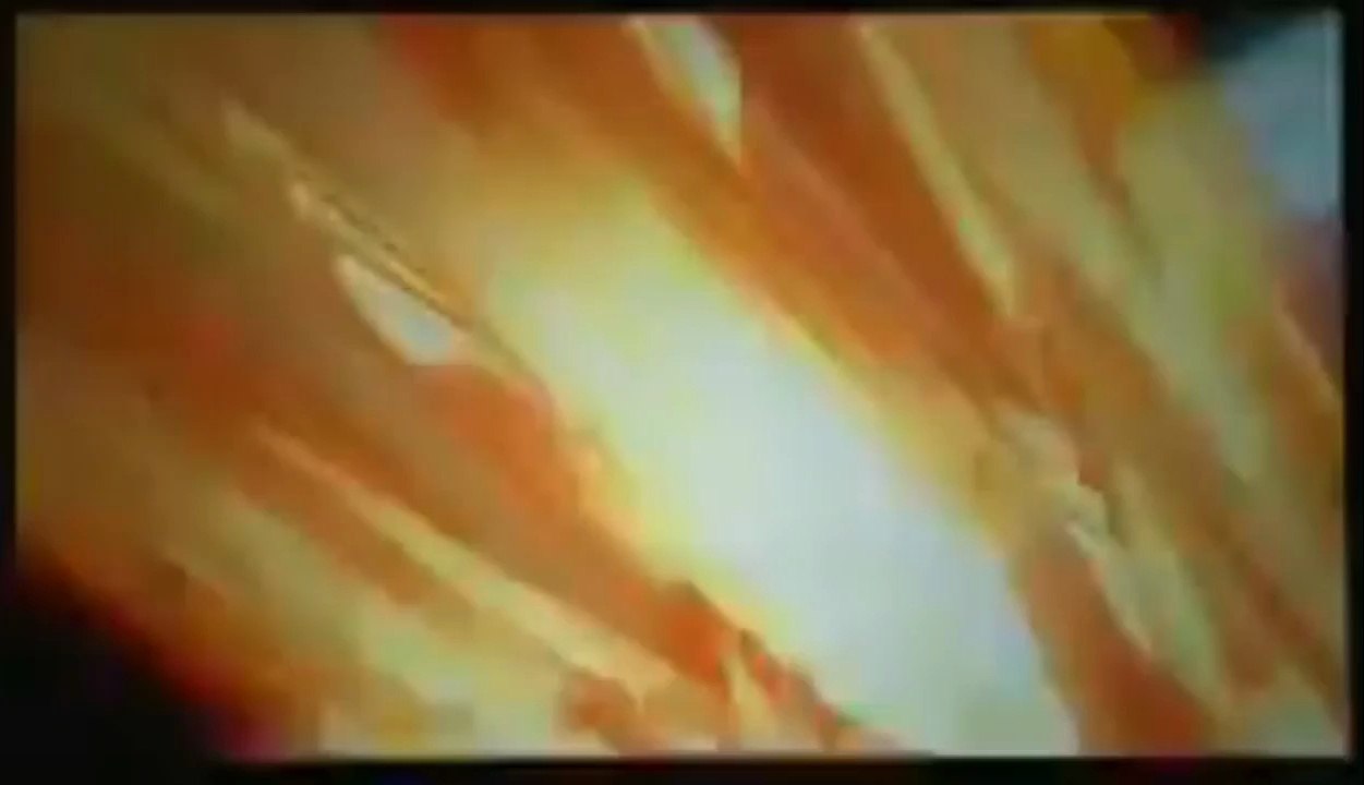 Zero PV