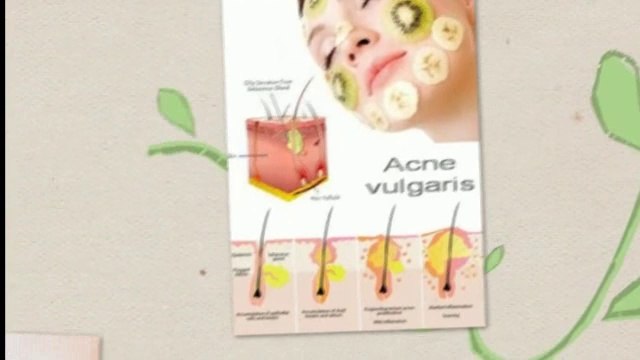 How To Get Rid Of Acne Scars Overnight