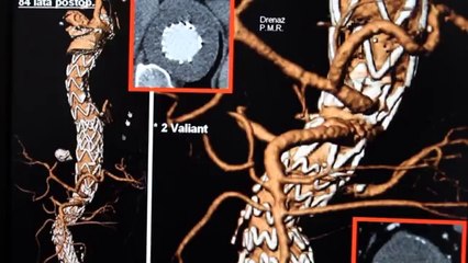Département de cardiologie (Mondor)