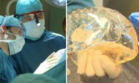 (GRAPHIC) Video: Woman Receives 3D-Printed Skull Replacement