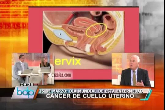 Consejos por el Día Mundial de Prevención contra el Cáncer de Cuello Uterino