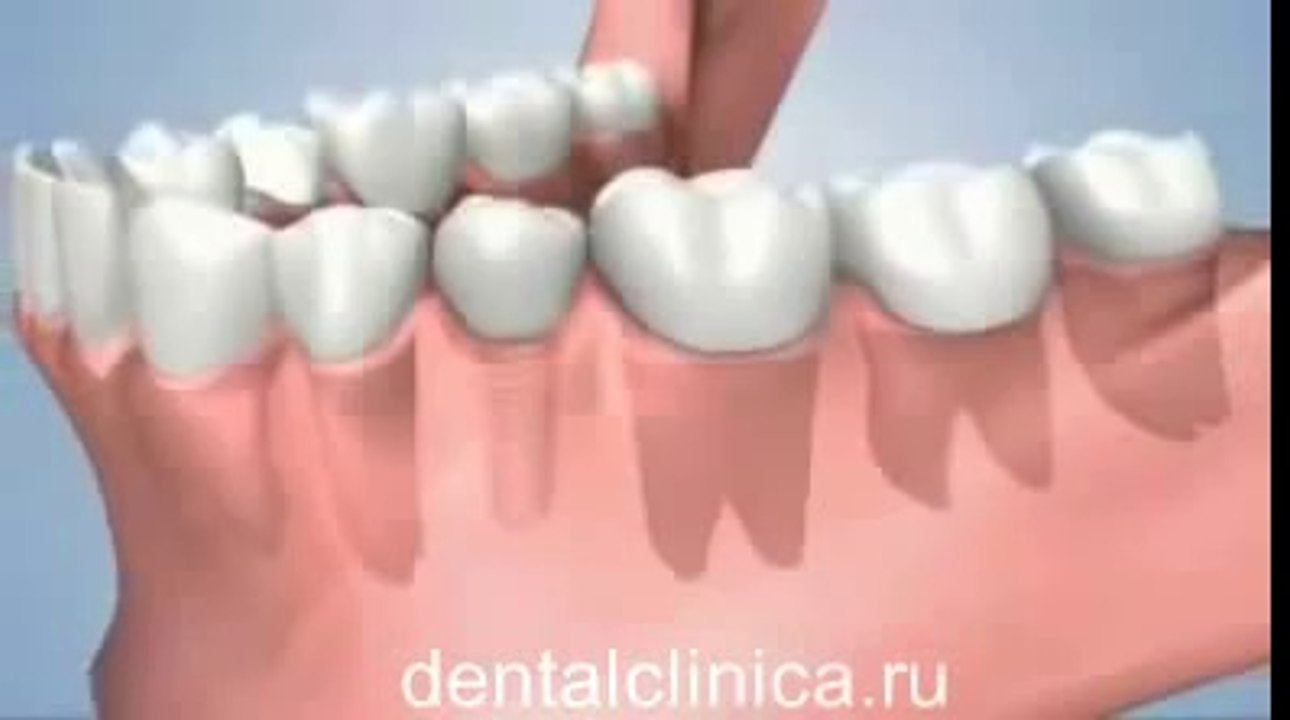 European Clinic of Aesthetic Dentistry Стоматология лечение протезирование имплантация пластическая хирургия экспресс-терапия восполнение кости лечебный туризм здоровье отдых