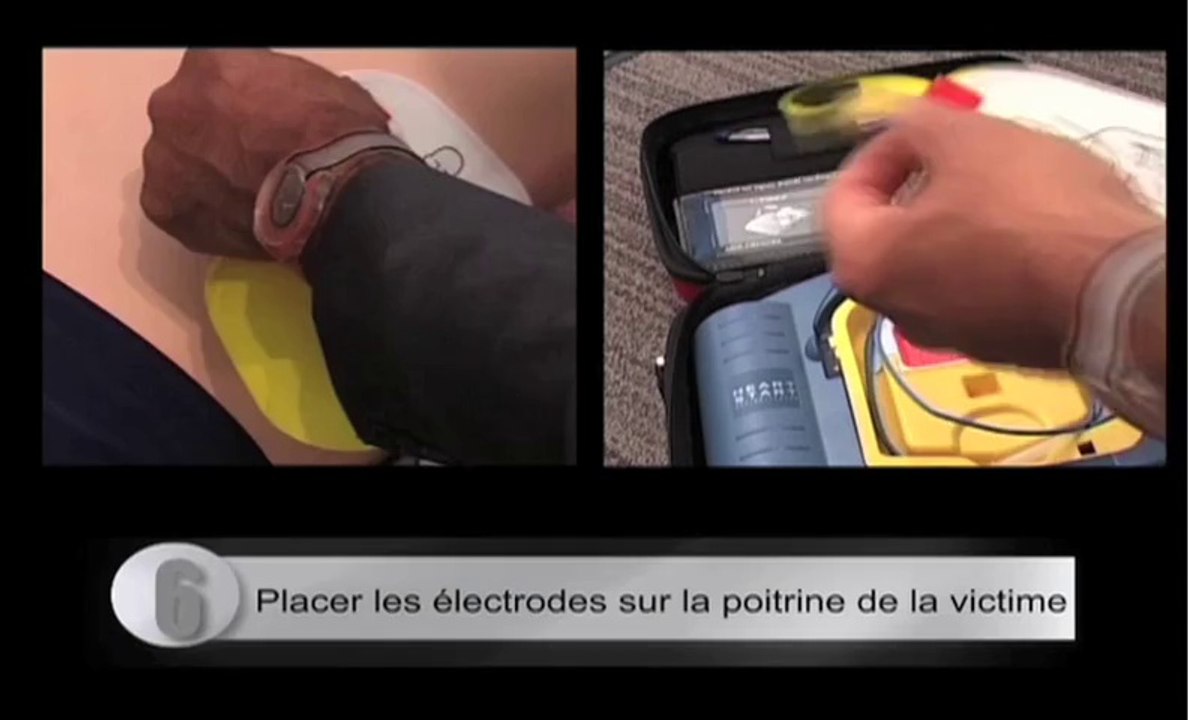 Prévention hiver - Le défibrillateur en 10 points