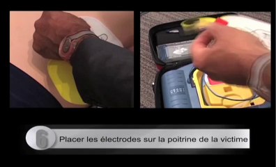 Prévention hiver - Le défibrillateur en 10 points