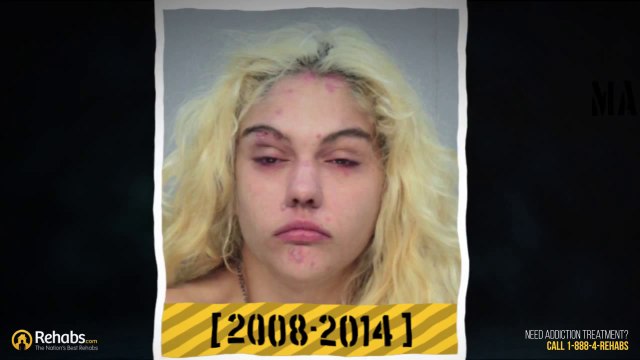 Avant / Après : Transformation du visage des drogués