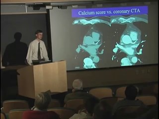 UCSF Radiology- Calcium Scoring vs. Coronary CTA Scan