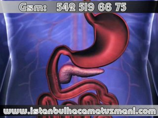 Hacamat ile şeker tedavisi