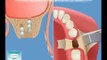 European Clinic of Aesthetic Dentistry Стоматология лечение зубов имплантация европейское качество низкие цены протезирование туризм путешествия отдых