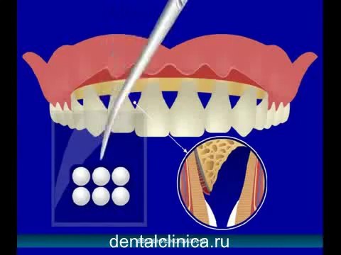 European Clinic of Aesthetic Dentistry Стоматология лечение зубов имплантация европейское качество низкие цены протезирование туризм путешествия отдых