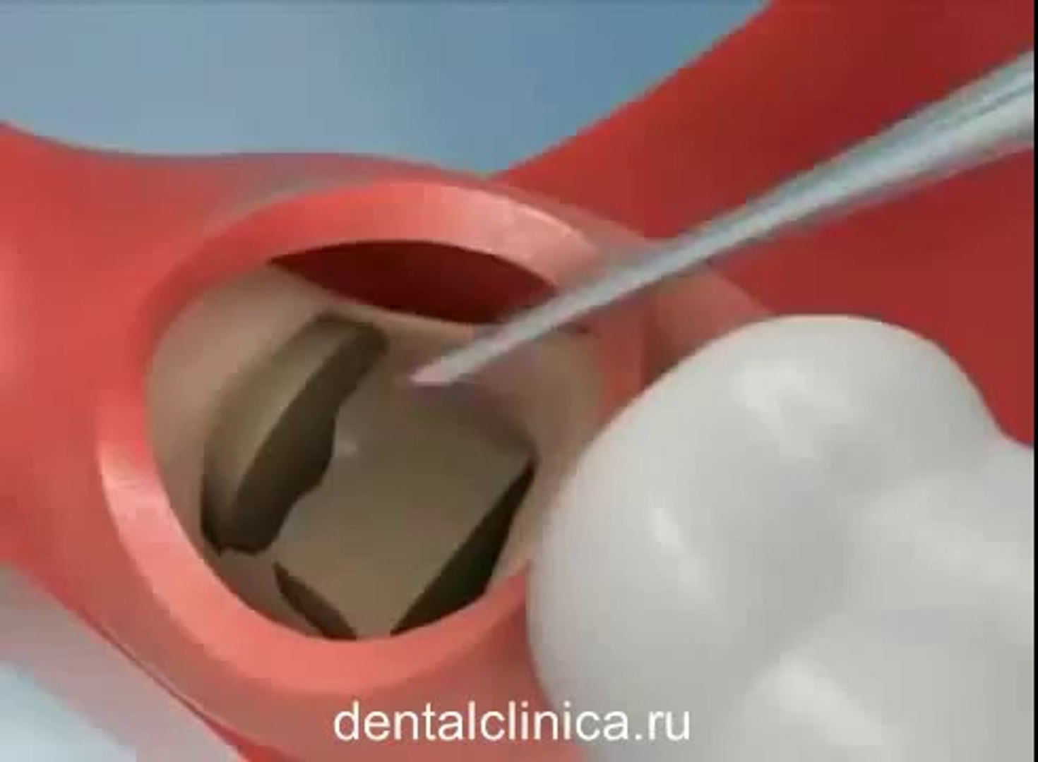 European Clinic of Aesthetic Dentistry Стоматология лечение зубов имплантация европейское качество н