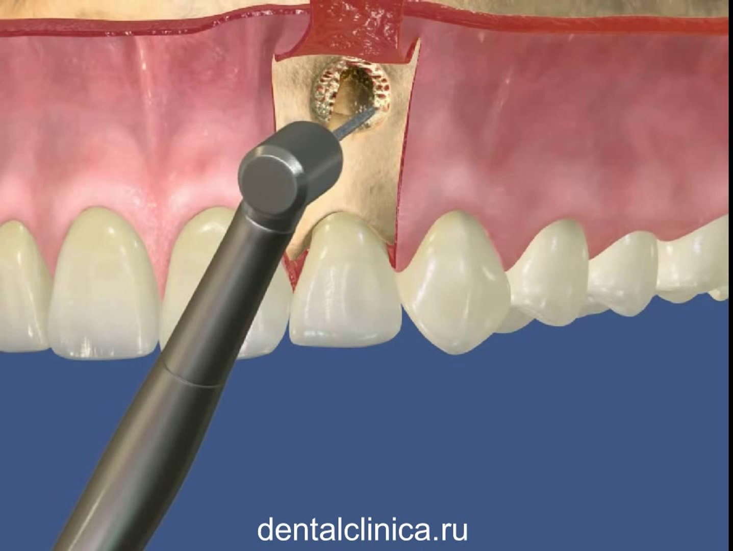 European Clinic of Aesthetic Dentistry Стоматология лечение зубов имплантация европейское качество н