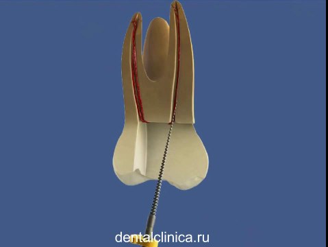 European Clinic of Aesthetic Dentistry Стоматология лечение зубов имплантация европейское качество низкие цены протезирование туризм путешествия отдых