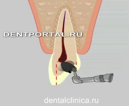 Стоматология лечение зубов в European Clinic of Aesthetic Dentistry in Budapest имплантация европейское качество низкие цены протезирование туризм