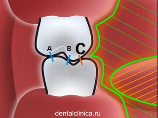 Стоматология лечение зубов в European Clinic of Aesthetic Dentistry in Budapest имплантация европейское качество низкие цены протезирование туризм
