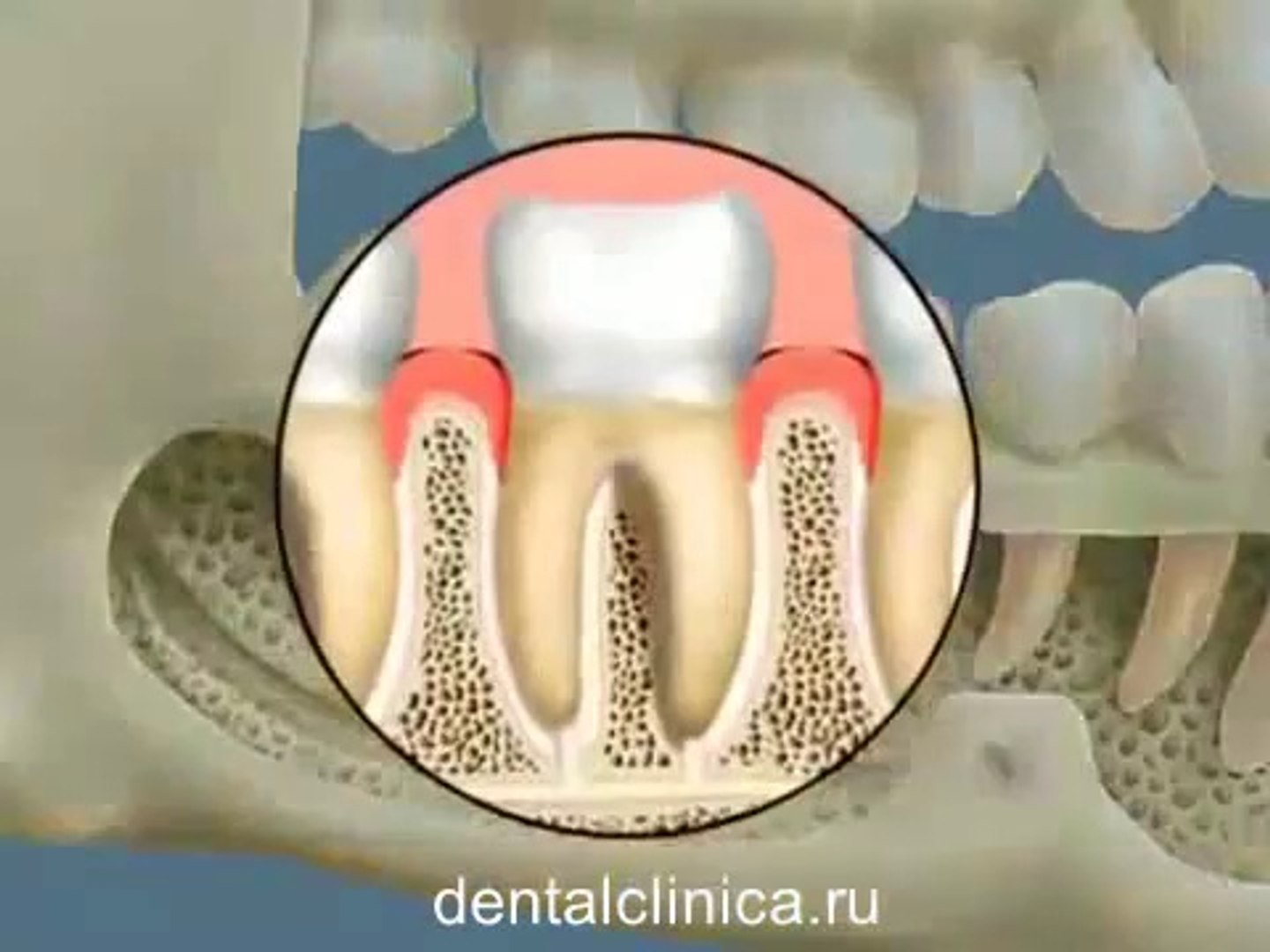 Стоматология лечение зубов вEuropean Clinic of Aesthetic Dentistry имплантация европейское качество 