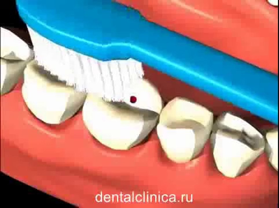 Стоматология лечение зубов в European Clinic of Aesthetic Dentistry in Budapest  имплантация европейское качество низкие цены протезирование