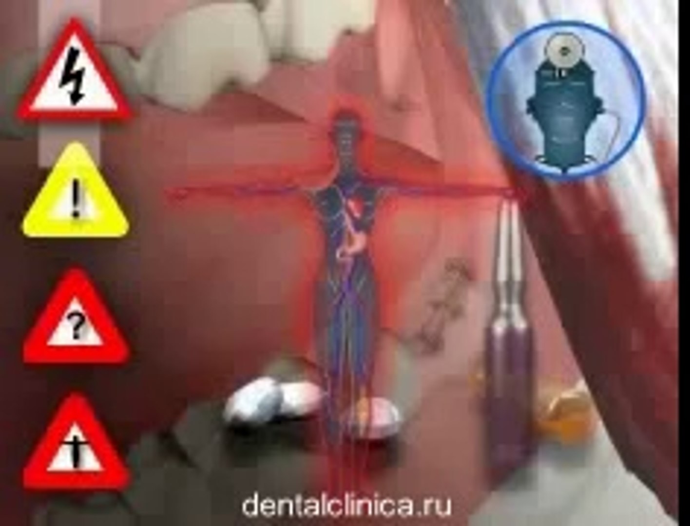 Стоматология лечение зубов вEuropean Clinic of Aesthetic Dentistry имплантация европейское качество 