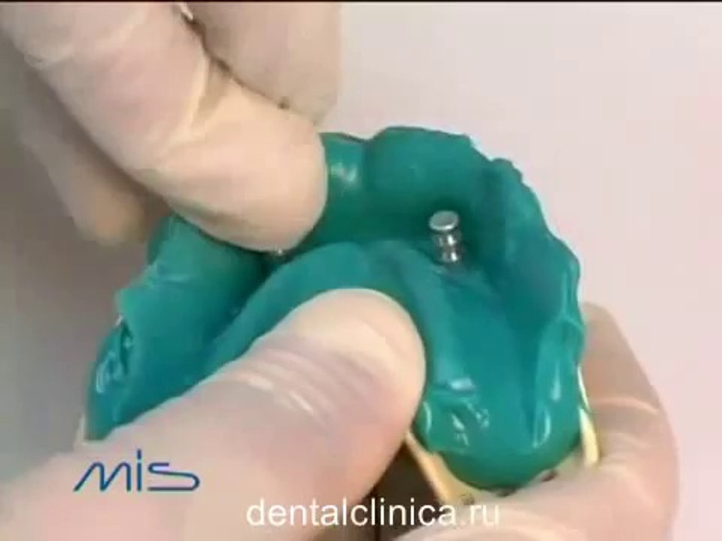 ⁣European Clinic of Aesthetic Dentistry in Budapest “Jewel Dental” “AVANTE” Стоматология лечение зубо