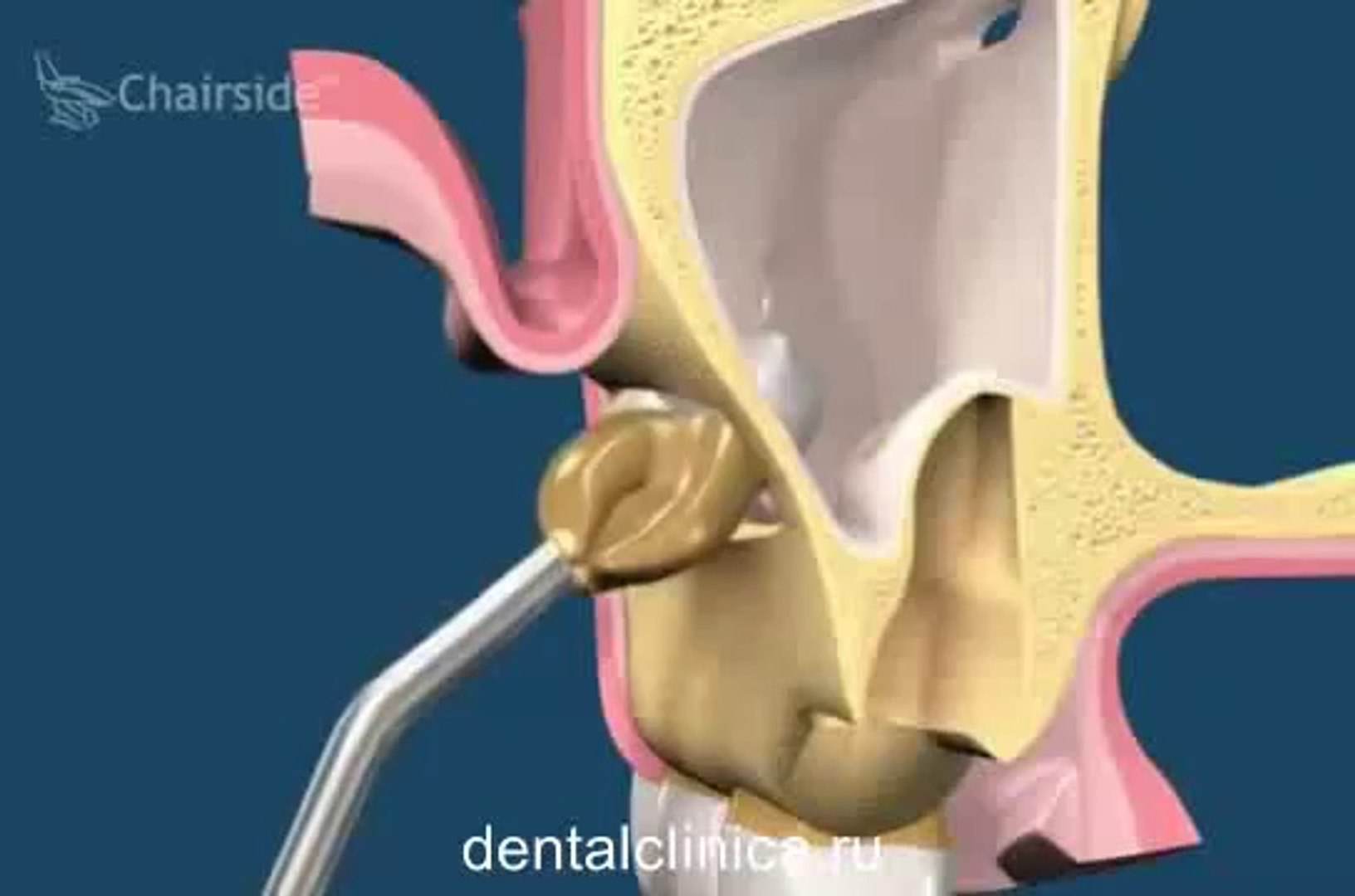 ⁣Стоматология лечение зубов в European European Clinic of Aesthetic Dentistry in Budapest “Jewel Dent
