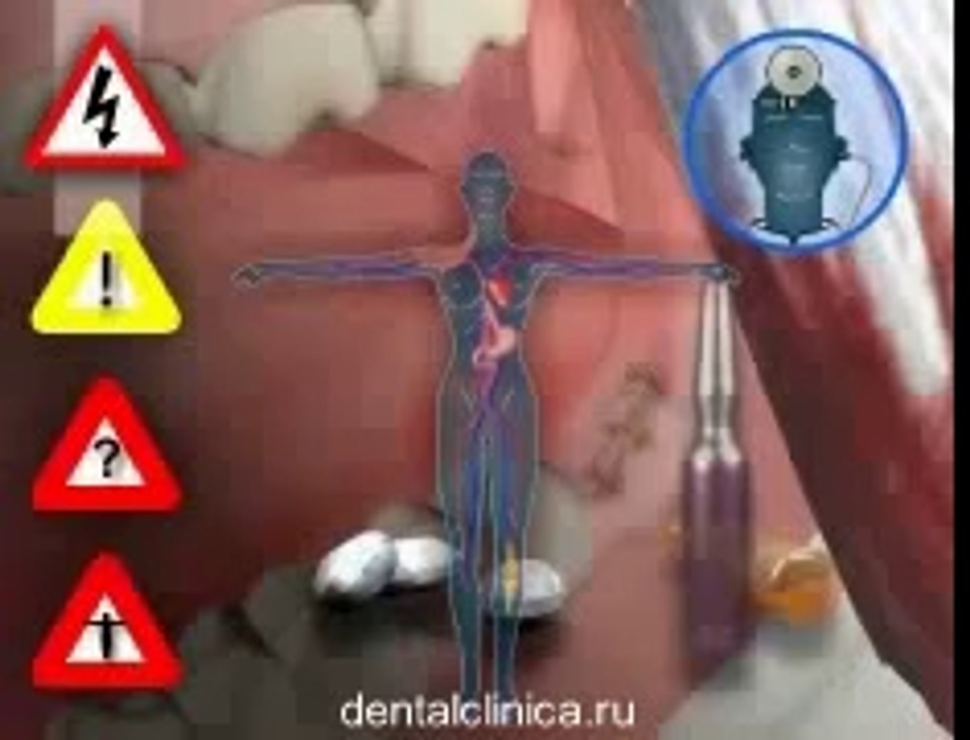 ⁣European Clinic of Aesthetic Dentistry in Budapest “Jewel Dental” “AVANTE” Dentist Medical Center Ст