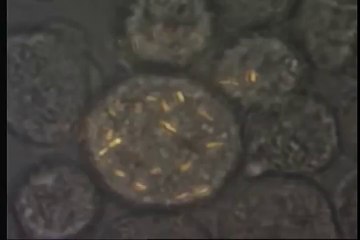 A demonstration of very active gold nanorods internalized inside HeLa cells in an acoustic field.