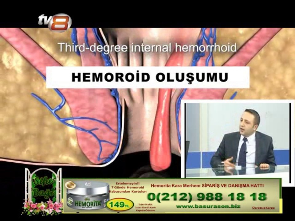 basur,hemoroid tedavisi hemorita kara merhem