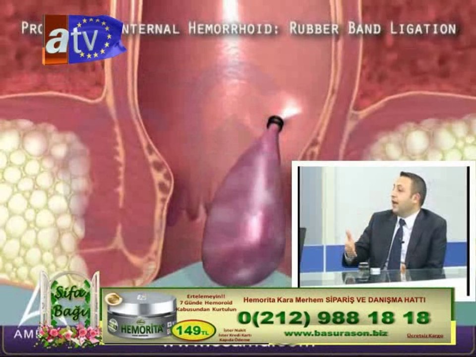 Hemoroid (Basur) Tedavisi. Hemorita Kara Merhem.