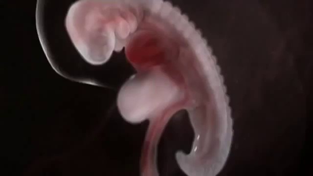 Беременность 5 недель(5 неделя беременности)