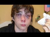 High school fight caught on camera: Georgia teen brutally beats up classmate