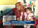 EPİDERMOLİZA BULLOSA ( CİLT RAHATSIZLIĞI ) VARDI BİTKİLERİ KULLANDI