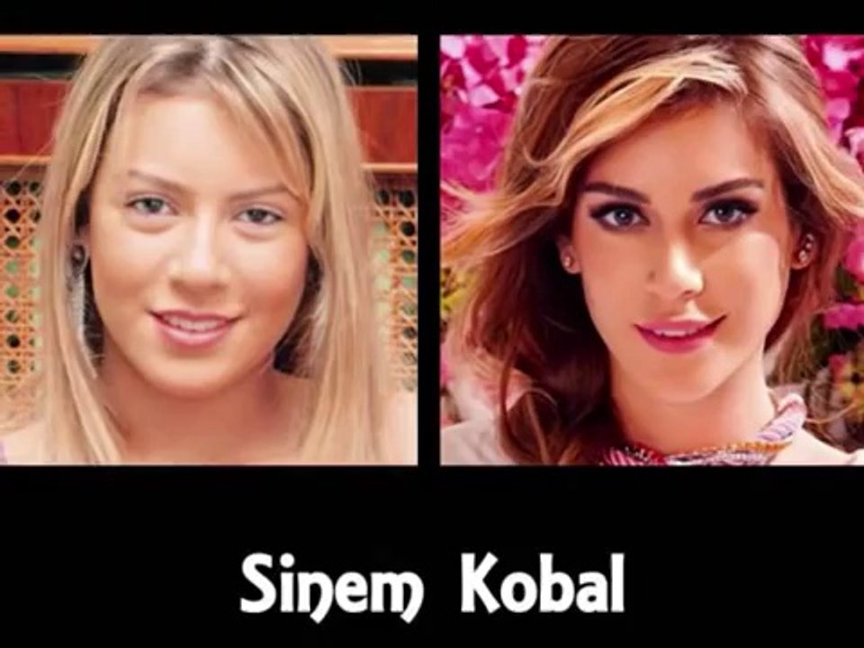 Ünlülerin Eski Halleri