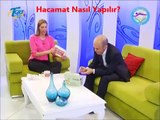 ANKARA HACAMAT - HACAMAT NASIL YAPILIR