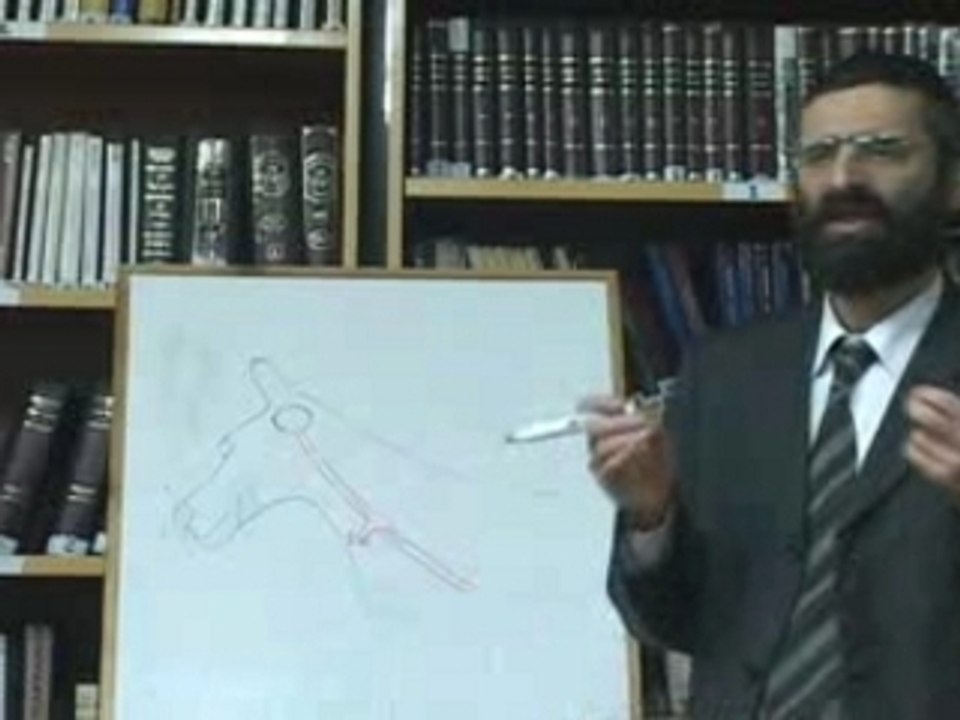 Le-polygone-de-Willis (rav-Ron-CHAYA)