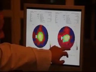 Retinitis Pigmentosa Treatment Gesichtsfeldtest (German)