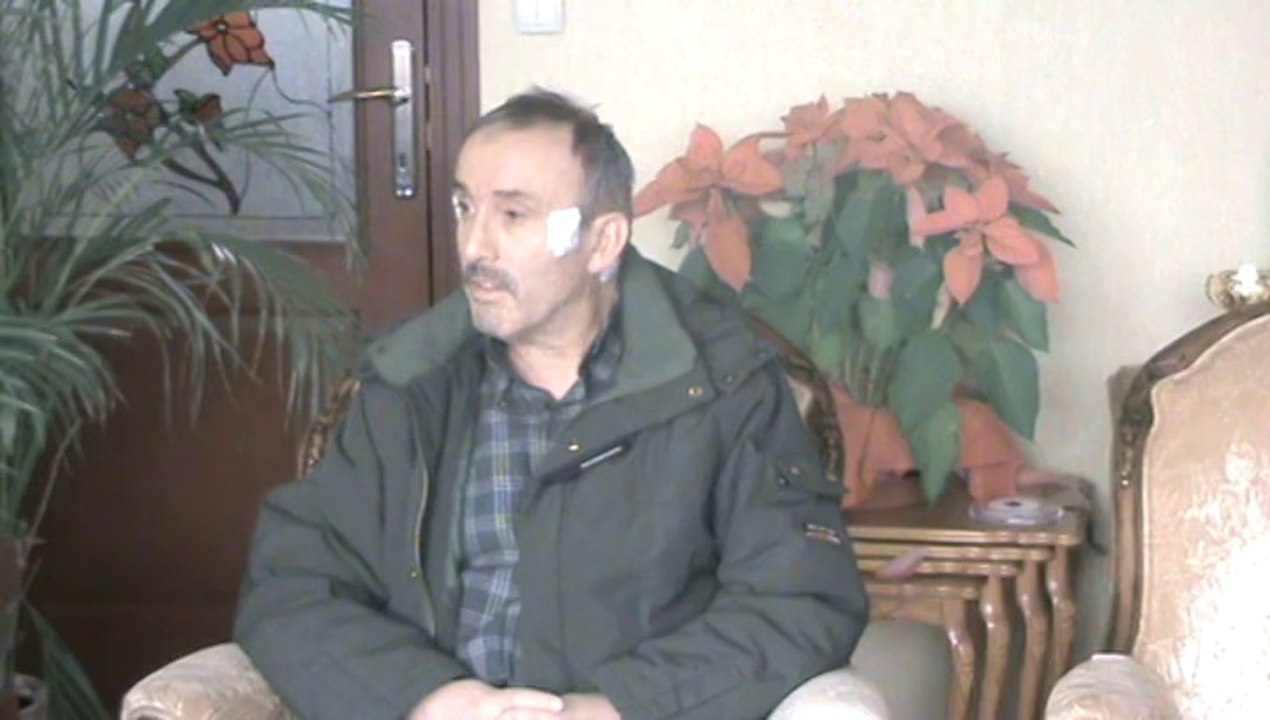 DR. SUAT ARUSAN DOĞAL TEDAVİLER-GÖZ KAPAĞI DÜŞÜKLÜĞÜ (BLEFAROPİTOZ)