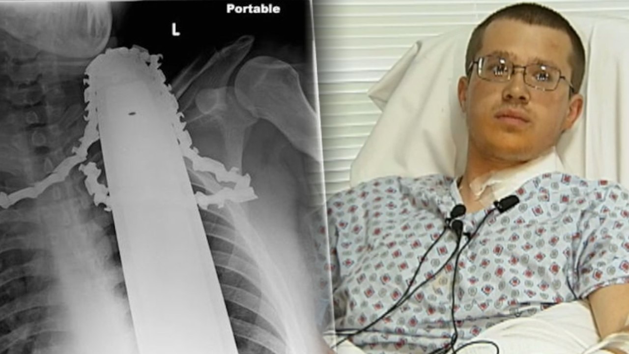 Man Survives Chainsaw in Neck