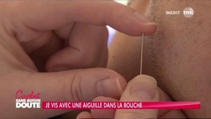 Il vit avec une aiguille de dentiste dans sa bouche