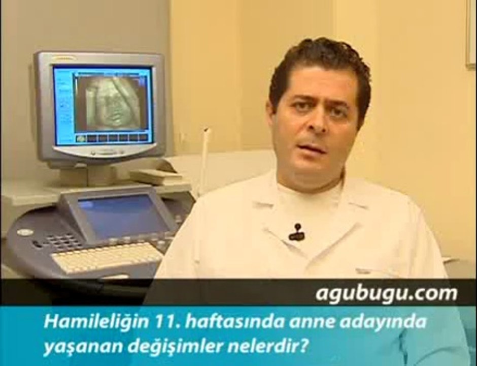 Hamileliğin 11. Haftası - Hafta Hafta Gebelik