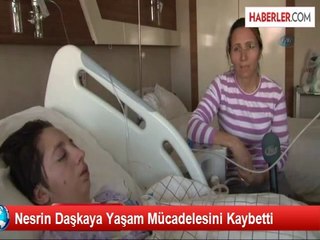 Nesrin Daşkaya Yaşam Mücadelesini Kaybetti
