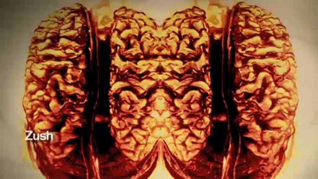 TV3 - 33 recomana - Res no s'atura. Fundació Suñol. Barcelona