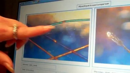 Hair Loss Treatments By Absolique Hair Health Clinic