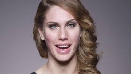 Makyaj Sen Nelere Kadirsin! Sivilceli Mankenin Makyajı