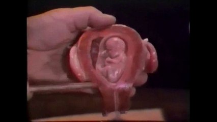 Silent Scream - Der stumme Schrei - 1984 - by ARTBLOO